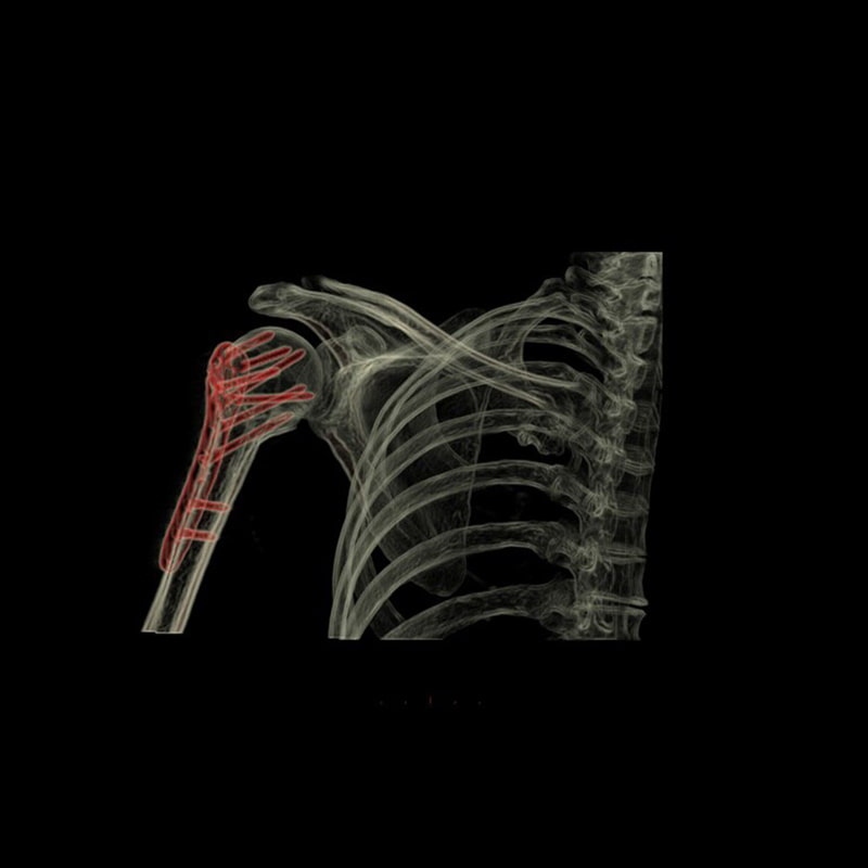 Спектральная КТ-система 256 срезов Revolution Discovery CT